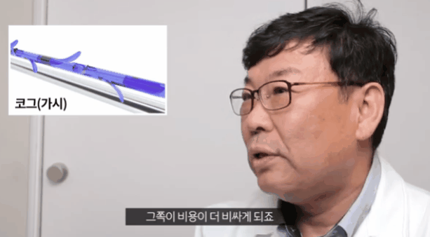Midface Lift Cost and Price: How Is It Different from Thread Lifting? image 2