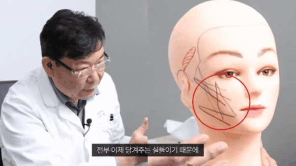 신사성형외과추천 얼굴리프팅 잘하는 곳 찾고 있다면 관련 이미지 4