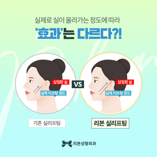 강남실리프팅 탱탱한 내 얼굴! 관련 이미지 3