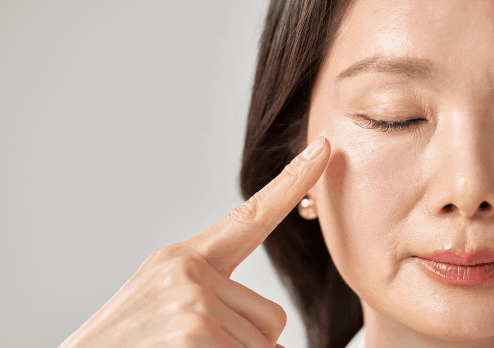 Is It Okay to Repeat Thread Lifting? Effects and Duration Based on Wrinkles and Facial Sagging image 3