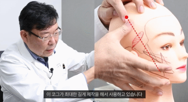 Mini Facelift Price? Check “This” Before Surgery and Decide. image 3