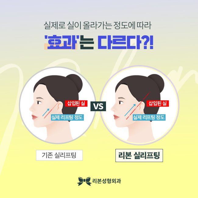 압구정실리프팅 예쁜 내 V라인 관련 이미지 3