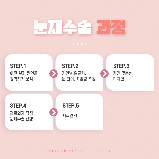 신사역성형외과 나의 눈을 다시 관련 이미지 2