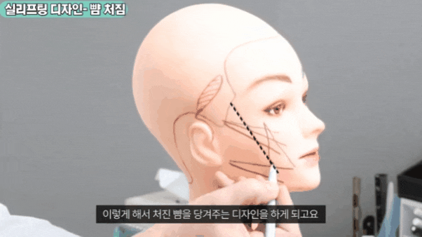 신사성형외과추천 얼굴리프팅 잘하는 곳 찾고 있다면 관련 이미지 2