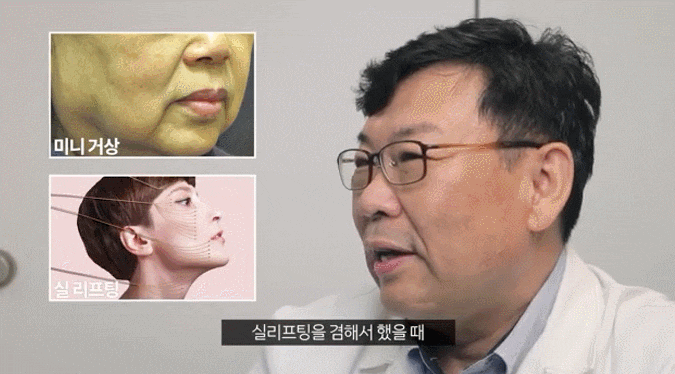 Two Ways to Improve Drooping Eyelids at a Plastic Surgery Clinic in Nonhyeon-dong image 1