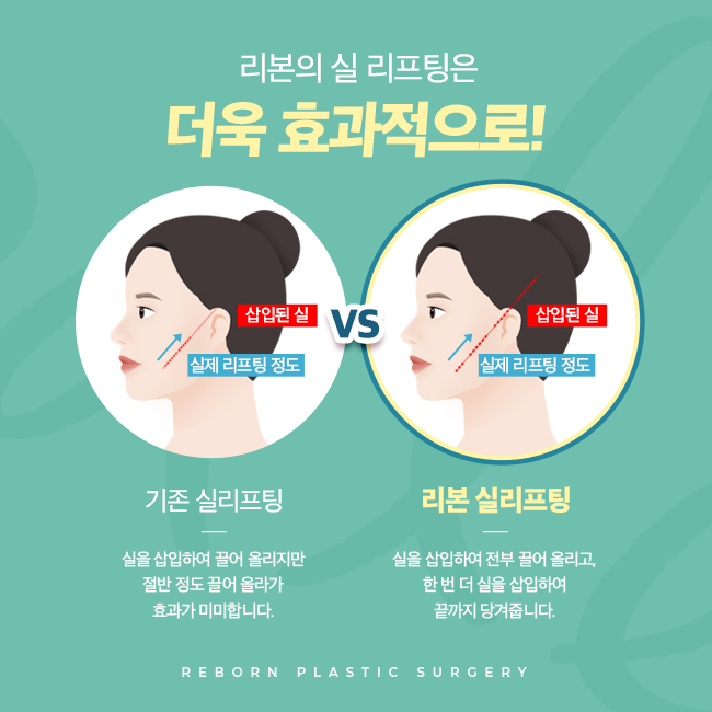 압구정역성형외과 탄력을 잃은 피부 해결방안은 관련 이미지 5