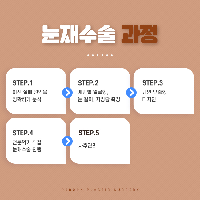 신논현성형외과 눈을 다시 관련 이미지 2