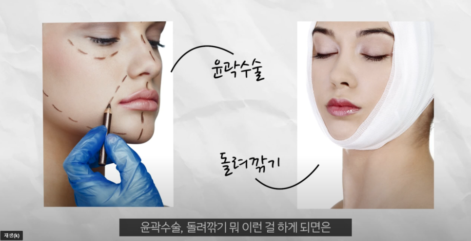 압구정 얼굴리프팅 적당한 때를 리본성형외과와 알아보자 관련 이미지 2