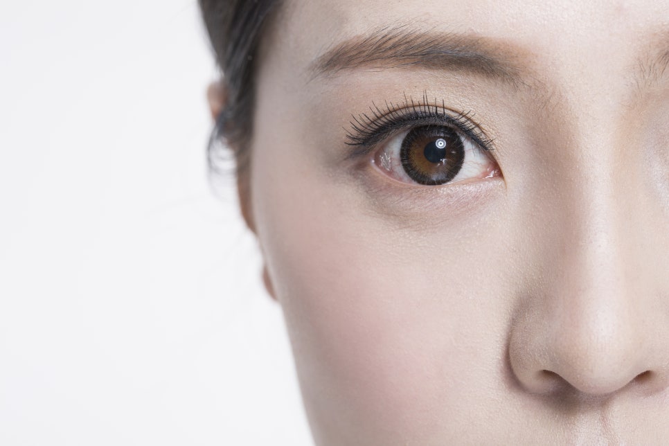 절개 비절개 눈매교정 수술 방법의 차이점에 대해 안내합니다 관련 이미지 3