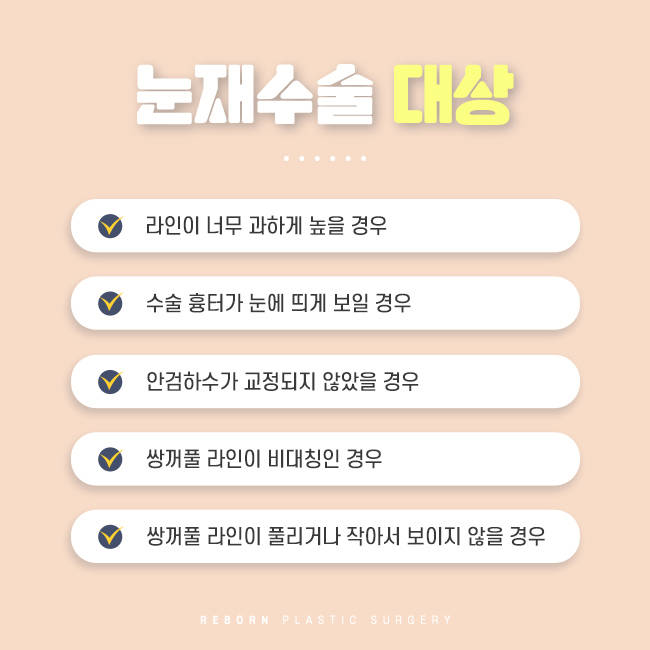 신사눈재수술 중요한 것은 뭘까 관련 이미지 3