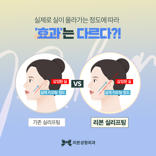 압구정역실리프팅 강력하게! 관련 이미지 3