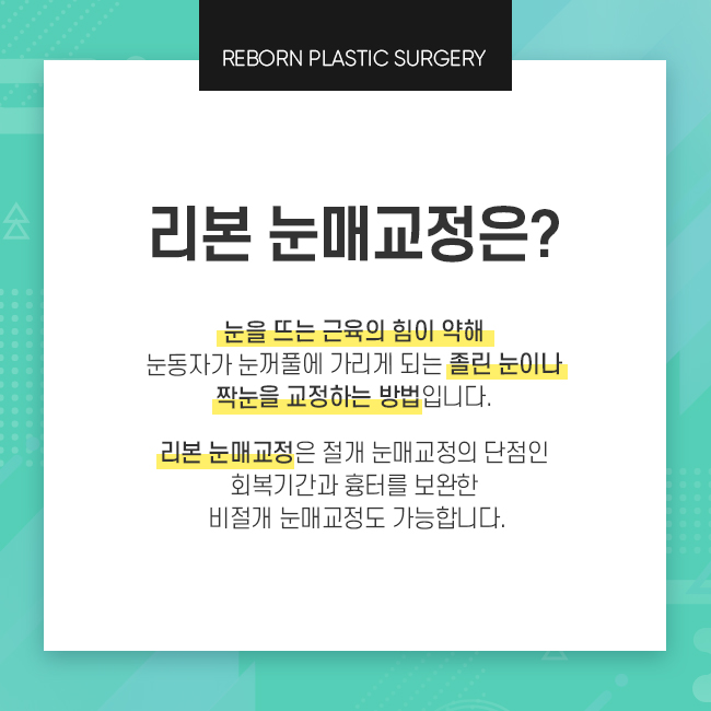 신사역눈매교정잘하는곳 여기가 진짜다! 관련 이미지 2