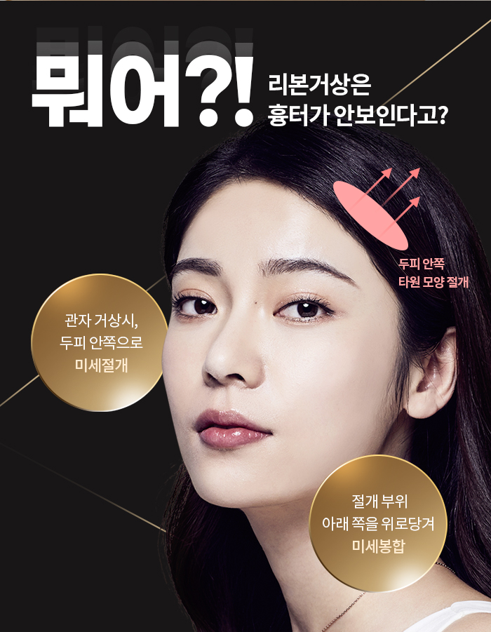 Apgujeong Lifting: If You Can’t Stop Time, Overcome It! image 10