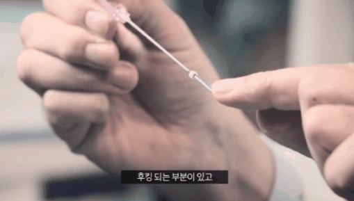Facelift Price and Cost: How Is It Different from Thread Lifting? image 2