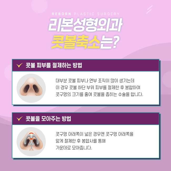 신사역콧볼축소 전체적인 균형 고려해야 관련 이미지 2