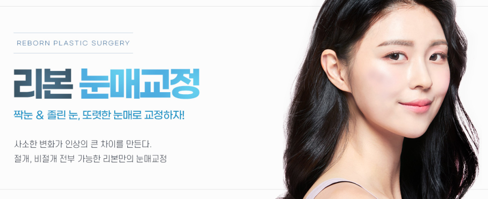 눈매교정전후 망하기 싫어 발품 팔다보면! 관련 이미지 3