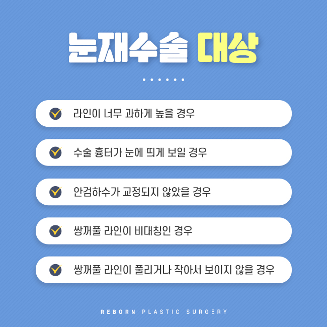 신사역눈재수술 잘하는 곳에서 해야 안심! 관련 이미지 3