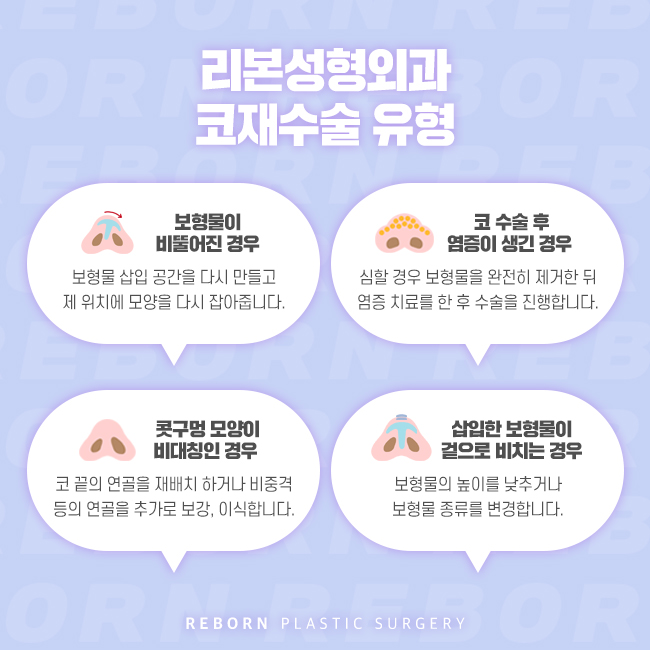 신사역코재수술 더 이상 실패하지 않도록 관련 이미지 3