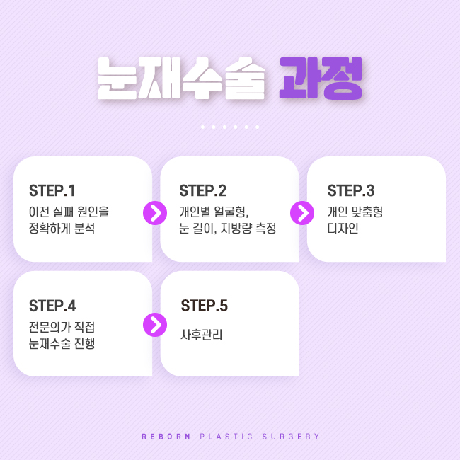 압구정눈재수술 다시 수정해야 할 때 관련 이미지 2