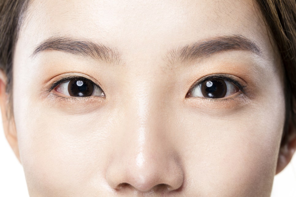 절개 비절개 눈매교정 수술 방법의 차이점에 대해 안내합니다 관련 이미지 1