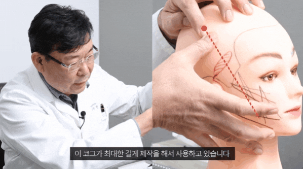 얼굴 실리프팅 가격, 비용만 보고 결정하면 안 됩니다 관련 이미지 2