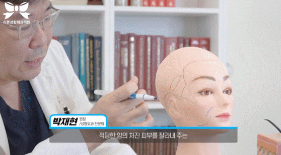 신논현 리프팅 잘하는곳? 관련 이미지 5