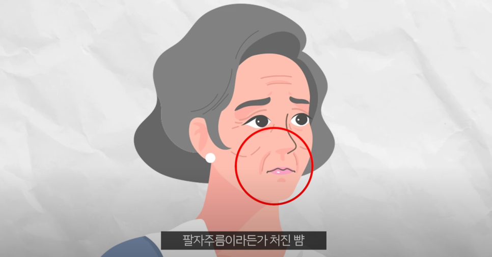 미니안면거상 리본성형외과에서 가심비 저격한 이유! 관련 이미지 4