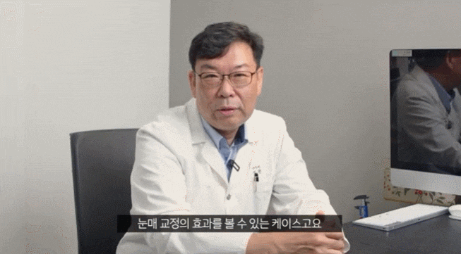 상안검하안검수술 동안 눈매와 생기있는 이미지를 위해 관련 이미지 3