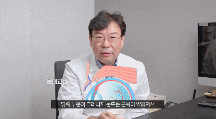 눈매교정수술 전후사진 찾는 분들은 꼭 보세요 관련 이미지 3