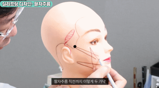 미니리프팅효과 제대로 못 보셨던 분들은 필독하세요 관련 이미지 3