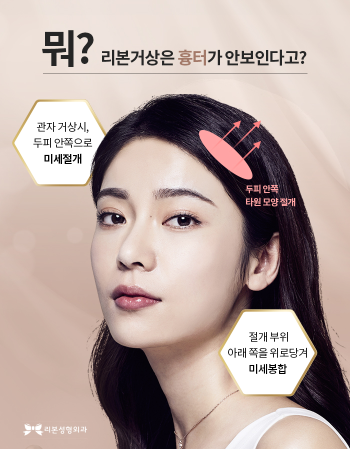 신사 미니거상술 효과 찐으로 보려면 관련 이미지 4
