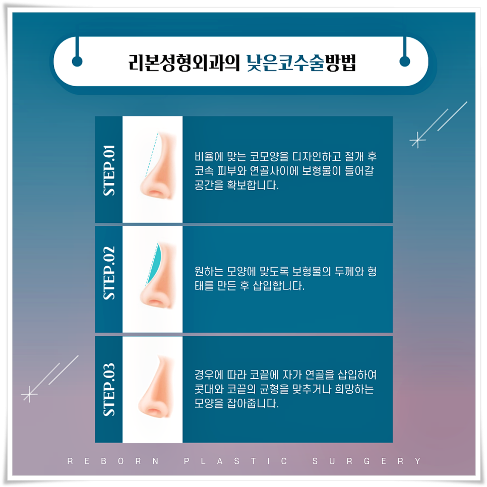 이제 낮은 코 안녕~! 난 이제 리본이랑 예쁜코만들래! [낮은코성형] 관련 이미지 3
