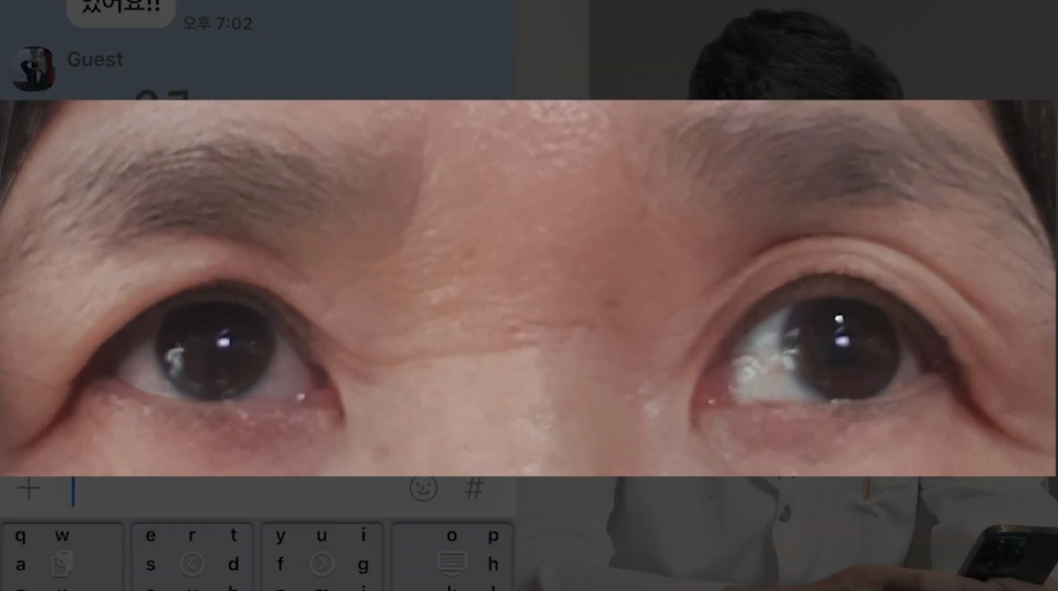 상안검 하안검 수술 후기 원장님 해결책을! 관련 이미지 1