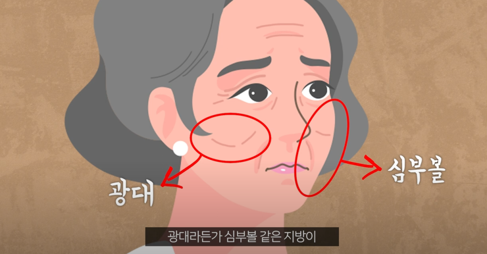 신논현성형외과 주름개선 후기 관련 이미지 5
