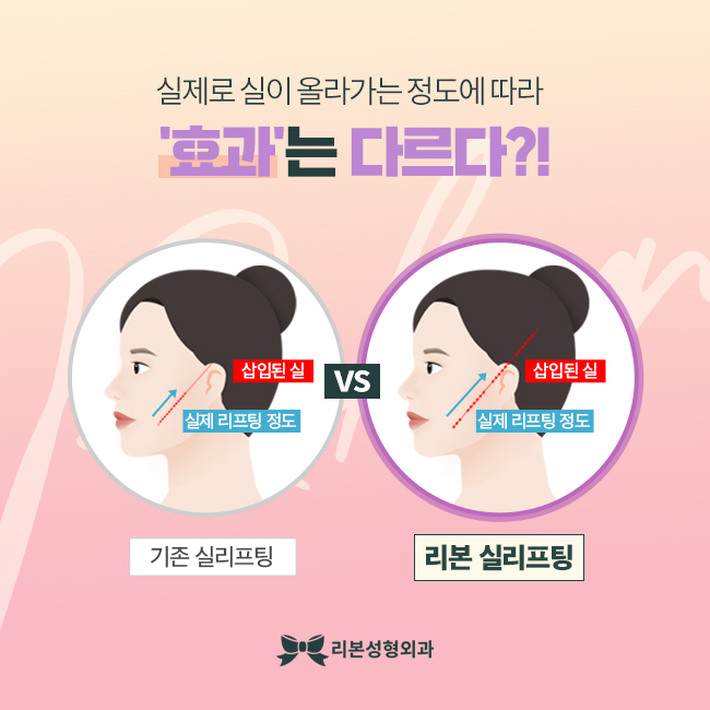 리본성형외과 리본리프팅과 함께 한다면 관련 이미지 3