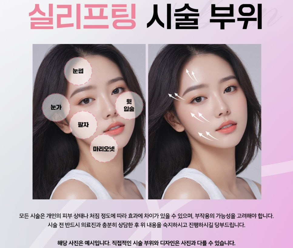 50대 리프팅 늘어진 피부를 즉각적으로 당겨주는 시술 관련 이미지 3