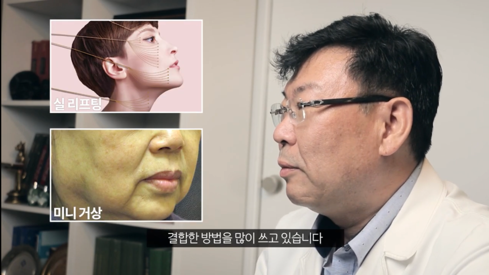 안면거상후기 미니안면거상 내돈내산 하기 전에 관련 이미지 4