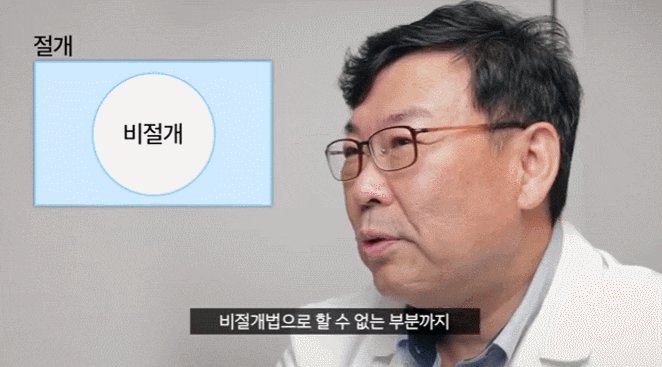신사역눈매교정? &lsquo;쌍꺼풀 수술&rsquo;과 더 이상 헷갈리지 마세요. 관련 이미지 3