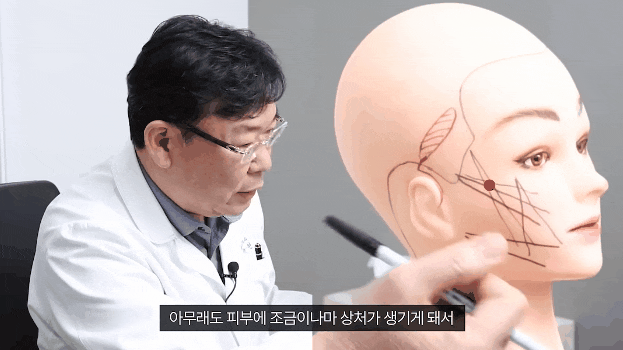 신사역 실리프팅 잘하는곳 광대부각, 딤플현상 등 걱정된다면 관련 이미지 3