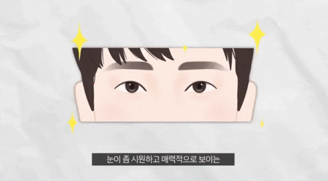 상안검하안검수술 동안 눈매와 생기있는 이미지를 위해 관련 이미지 1