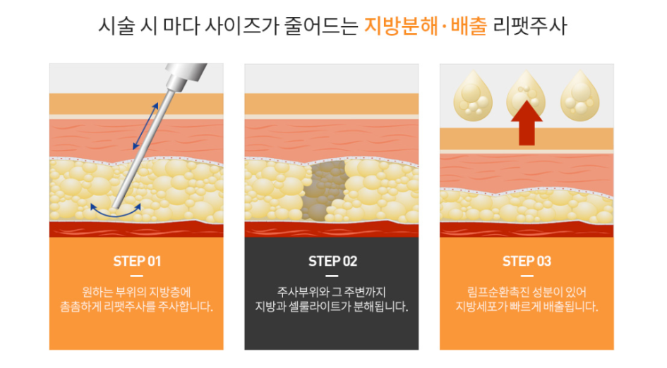 A Good Place for Diet Injections in Sinsa-dong: Keep These Points in Mind When Searching image 3