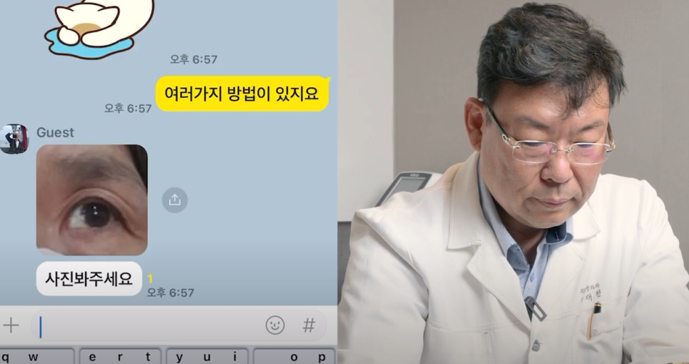 신사 중년눈성형 후기 처진눈을 올려라! 관련 이미지 1