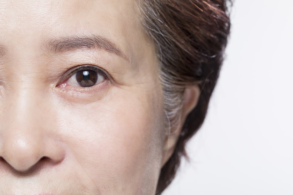 신사 상안검수술 처진눈성형 실패하지 않으려면 필독해주세요 관련 이미지 1
