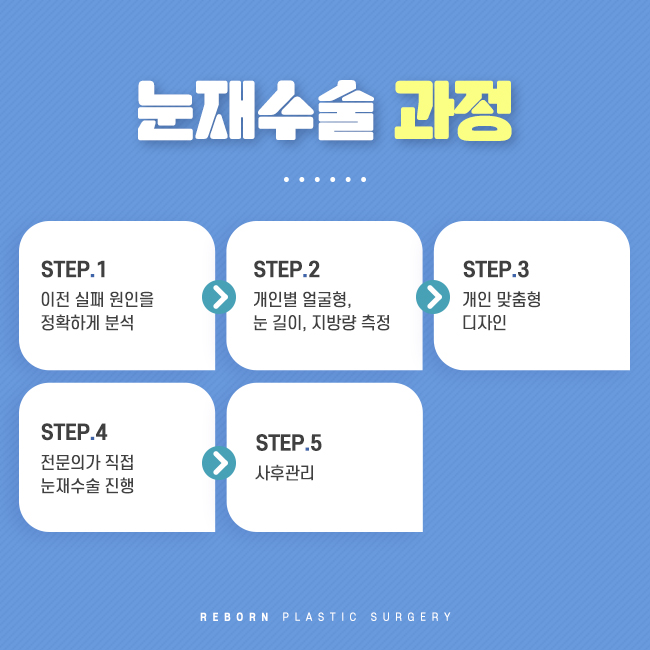 신사역눈재수술 잘하는 곳에서 해야 안심! 관련 이미지 2