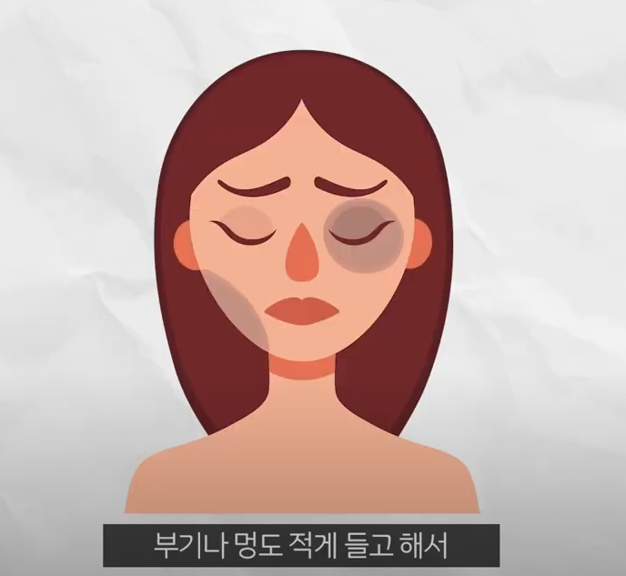강남 미니거상 효과 잘 보려면 이게 포인트 관련 이미지 10
