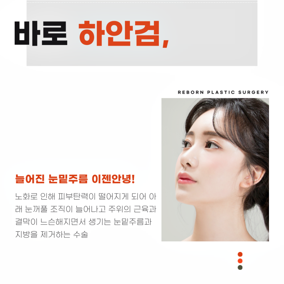 눈밑주름없애는방법 리본에서 하안검성형으로! 관련 이미지 3