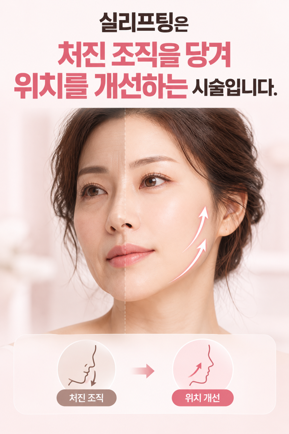 실리프팅 후 얼굴 처짐 원인 무엇일까, 개인별 시술 중요한 이유 관련 이미지 1