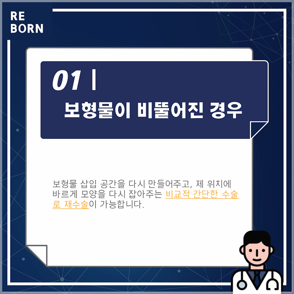 코재수술후기 좋은 리본에서 알려드리는 재수술방법! 관련 이미지 2