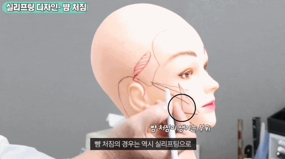 처진 볼살 실리프팅 매력적인 얼굴라인을 얻으려면? 관련 이미지 2