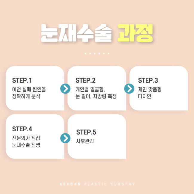 신사눈재수술 중요한 것은 뭘까 관련 이미지 2